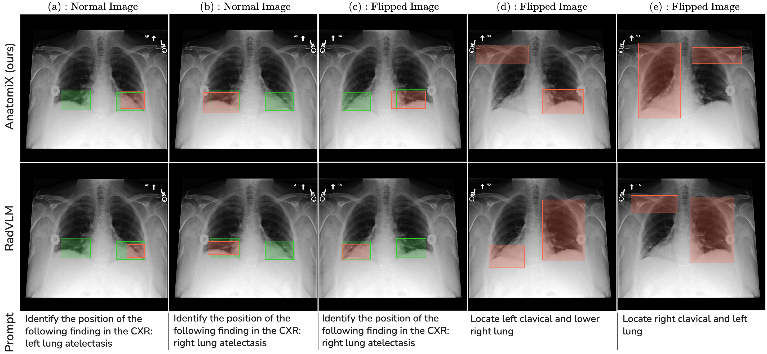Comparison between AnatomiX and RadVLM in anatomy understanding